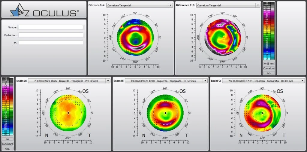 Topografías del tratamiento OI